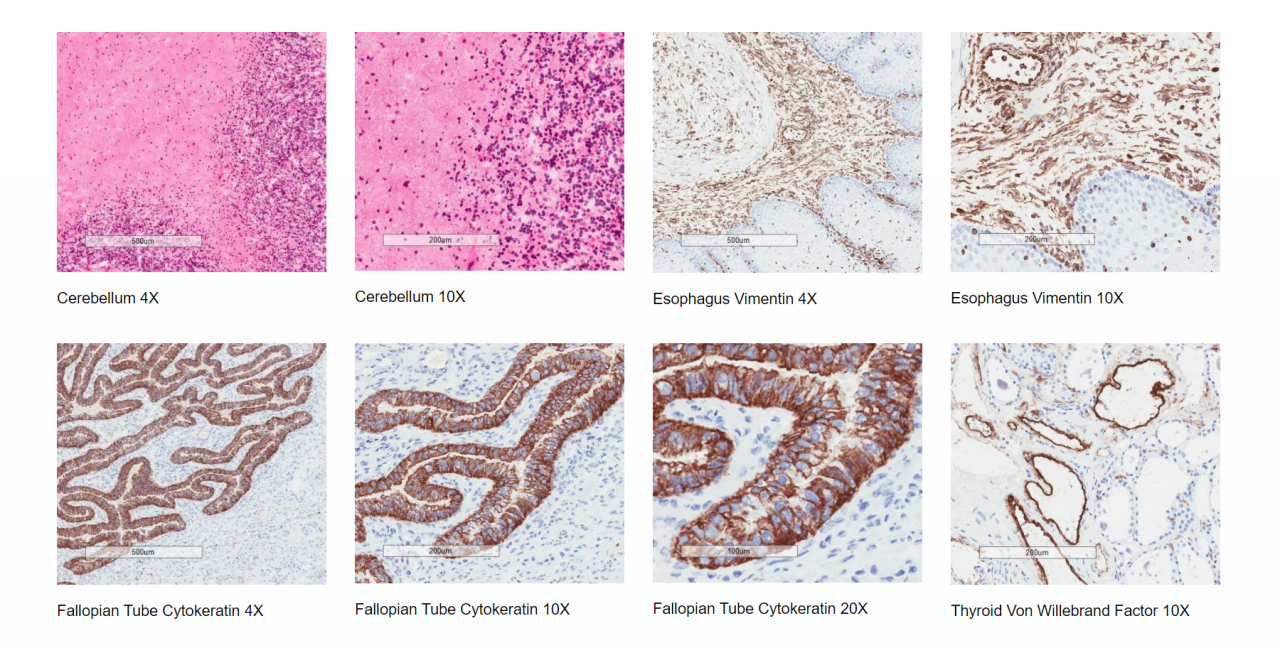 Ejemplos de evaluación de calidad de tejido humano congelado. Primera línea: cerebelo 4x, cerebelo 10x, vimentina de esófago 4x, vimentina de esófago 10x. Segunda línea: citoqueratina de trompa de Falopio 4x, citoqueratina de trompa de Falopio 10x, citoqueratina de trompa de Falopio 20x, factor Von Willebrand de tiroides 10x